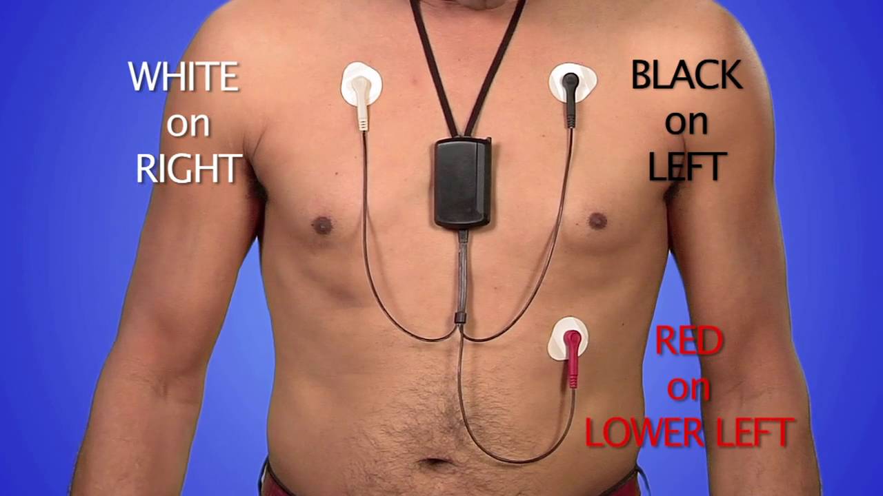 mcot heart monitor mcot heart monitor